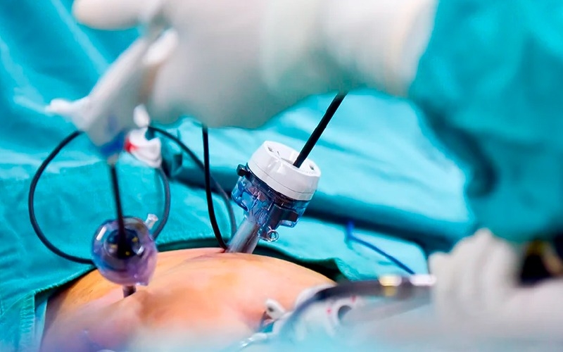 2do Congreso de Cirugía Mínimamente Invasiva de Córdoba.